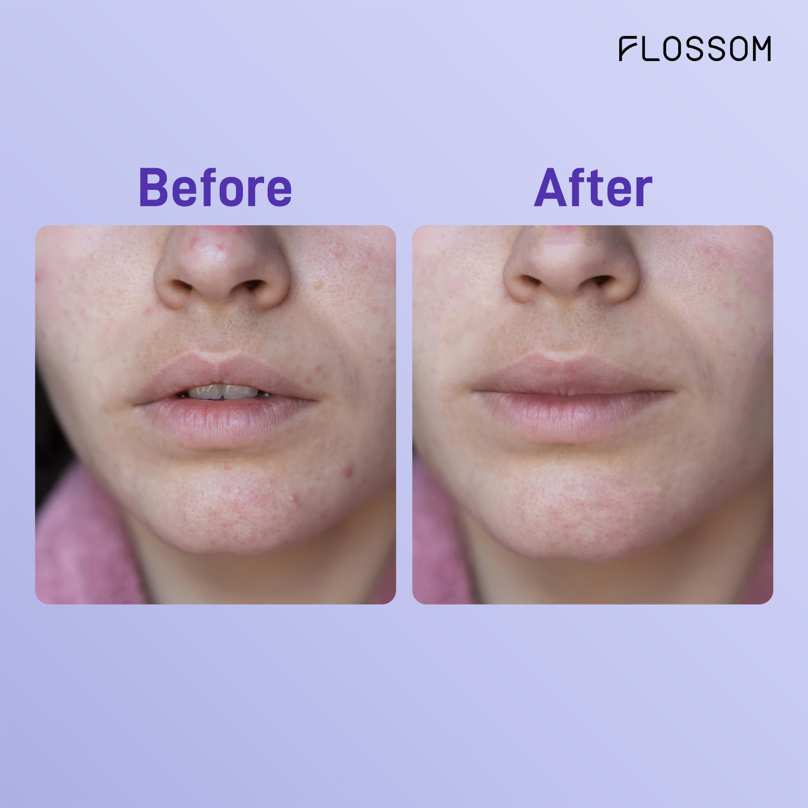 Flossom智能美白修復LED光能艙